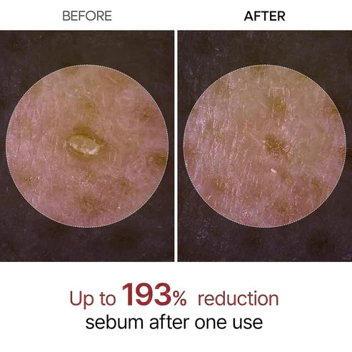 Final 3 Hours: 42% OFF🔥 Gentle Exfoliator Glow Rice Ampoule-Suitable for All Skin Types