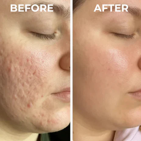 🌿Dual Action Real Deep Collagen Sheets for both wrinkle smoothing and new or old scar fading