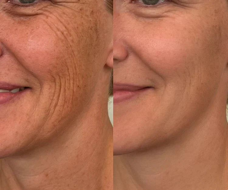 🌿Dual Action Real Deep Collagen Sheets for both wrinkle smoothing and new or old scar fading