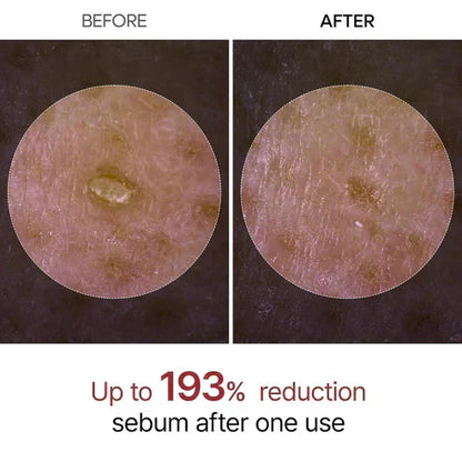 Final 3 Hours: 42% OFF🔥 Gentle Exfoliator Glow Rice Ampoule-Suitable for All Skin Types