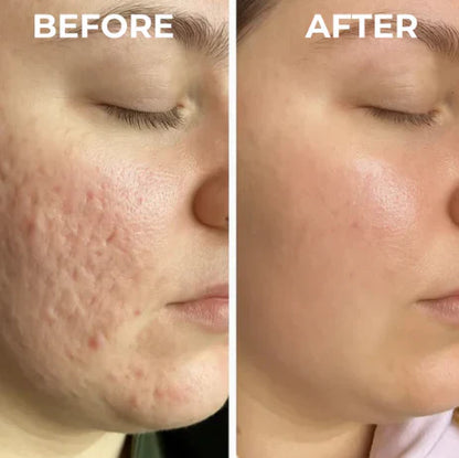 🌿Dual Action Real Deep Collagen Sheets for both wrinkle smoothing and new or old scar fading