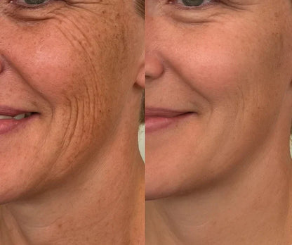 🌿Dual Action Real Deep Collagen Sheets for both wrinkle smoothing and new or old scar fading